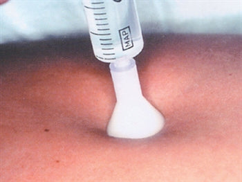S.I.T. HÚÐSPRAUTUNARÞJÓNUSTA 31G 0,26X2.5 mm - hvítur - 23694