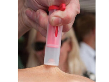 UNSTINGER skordýra eitur útdráttar tæki - 24395