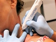 CRYOCLEAR FRYSTITÆKI með 16 g hylki – mynd 5