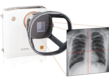 REMEX KA6 X-RAY SET: myndavél (32000) + skynjari 43x43 cm + fartölva með hugbúnaði - 32000