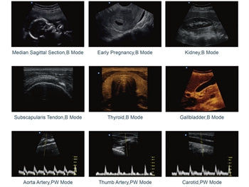 CHISON ECO2 SVART/HVÍT ULTRASOUND - 1 skynjari tengi - 33862