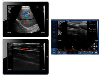 VIATOM DUAL HEAD LÍNÚR/KÚRFU ÞRÓTTUR PORTABLE ULTRASOUND - 33932