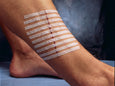 STERI-STRIP 3M – 100 x 6 mm – mynd 3