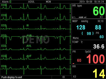 PC-3000 MULTI-PARAMETER PATIENT MONITOR - 35134