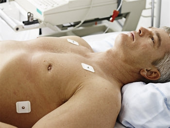 AMBU WHITESENSOR 4200 ECG RAFEINDIR - snap - 53902