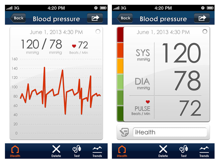 iHealth SENSE BP7 Blóðþrýstingsmælir - úlnlið – mynd 4