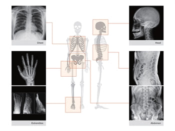 REMEX KA6 X-RAY SET: myndavél (32000) + skynjari 43x43 cm + fartölva með hugbúnaði - 32000