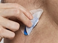 AMBU BLUE SENSOR VL hjartalínuritselektroður - smellufesting – mynd 3