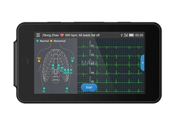 PCECG-500 POCKET ECG MONITOR - 33236