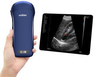 VIATOM 3 Í 1 LÍNÚR/KÚRFU/HJARTA ÞRÓTTUR PORTABLE ULTRASOUND - 33934