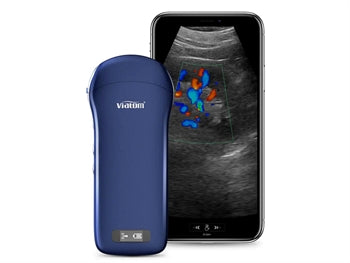 VIATOM 3 Í 1 LÍNÚR/KÚRFU/HJARTA ÞRÓTTUR PORTABLE ULTRASOUND - 33934