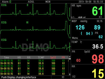 PC-3000 MULTI-PARAMETER PATIENT MONITOR - 35134