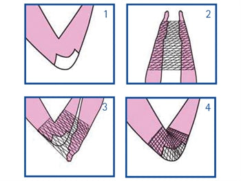 TEYGJANLEG NET C fyrir hendi, olnboga, arm - latex frítt - 58903