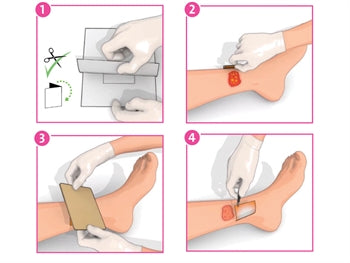 INADINE™ PVP-I NON ADHESIVE DRESSING 5x5 cm - 59575